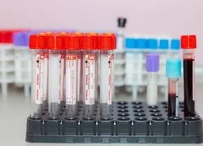 ANAD i-a dat contractul pentru controale antidoping, prin achiziție directă, unei firme abia înființ