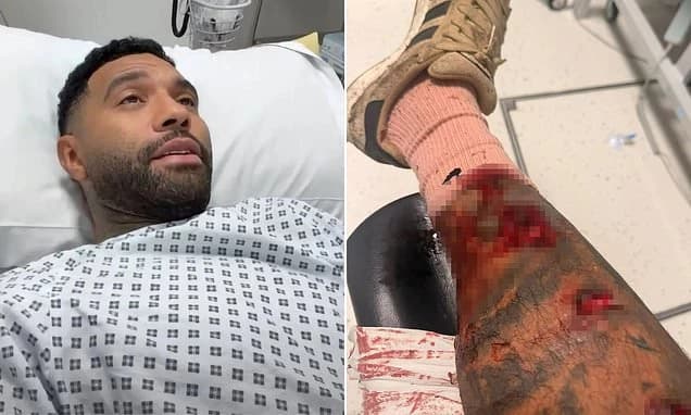 Ex-Premier League player Jermaine Pennant is left needing 50 stitches after being mauled by dog whil