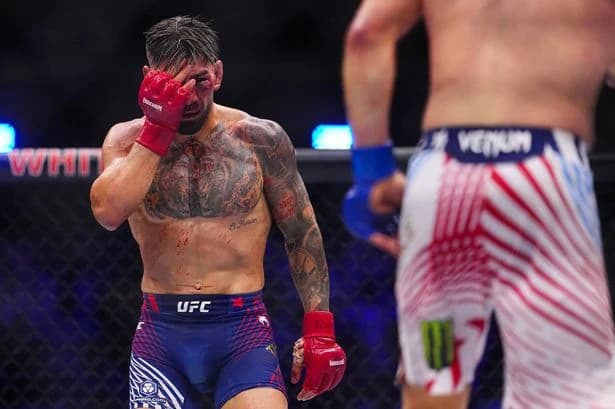 Ilia Topuria injuries revealed after brutal Justin Gaethje defeat