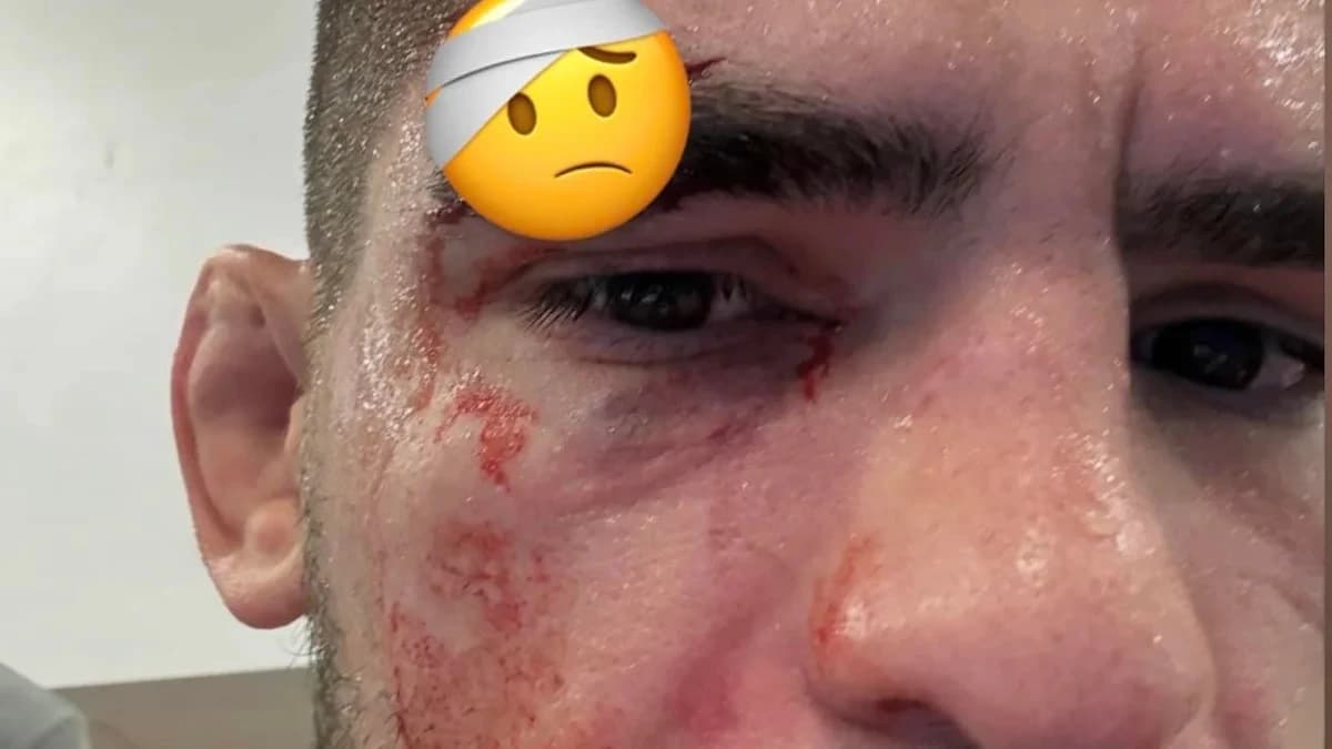 Pic: Nasty cut boots Gaston Bolanos from UFC Vegas 123, replacement steps in