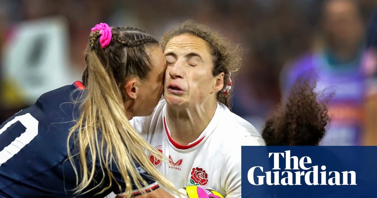 Pioneering study aims to find out how repeated blows to head in women’s rugby affects brain
