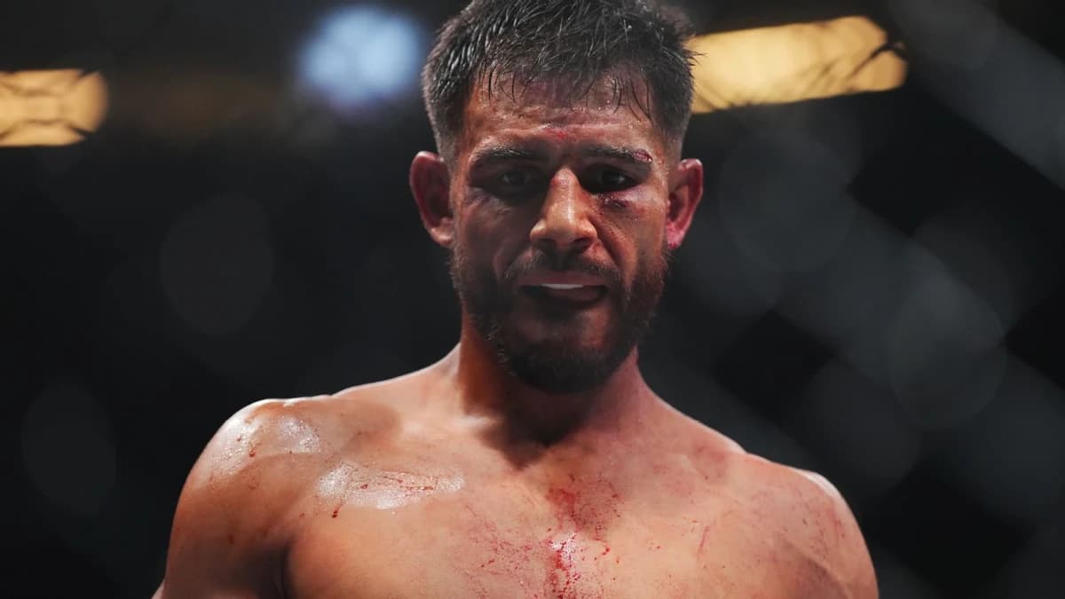 Rodriguez out of Silva bout at UFC Noche, replaced by Delgado