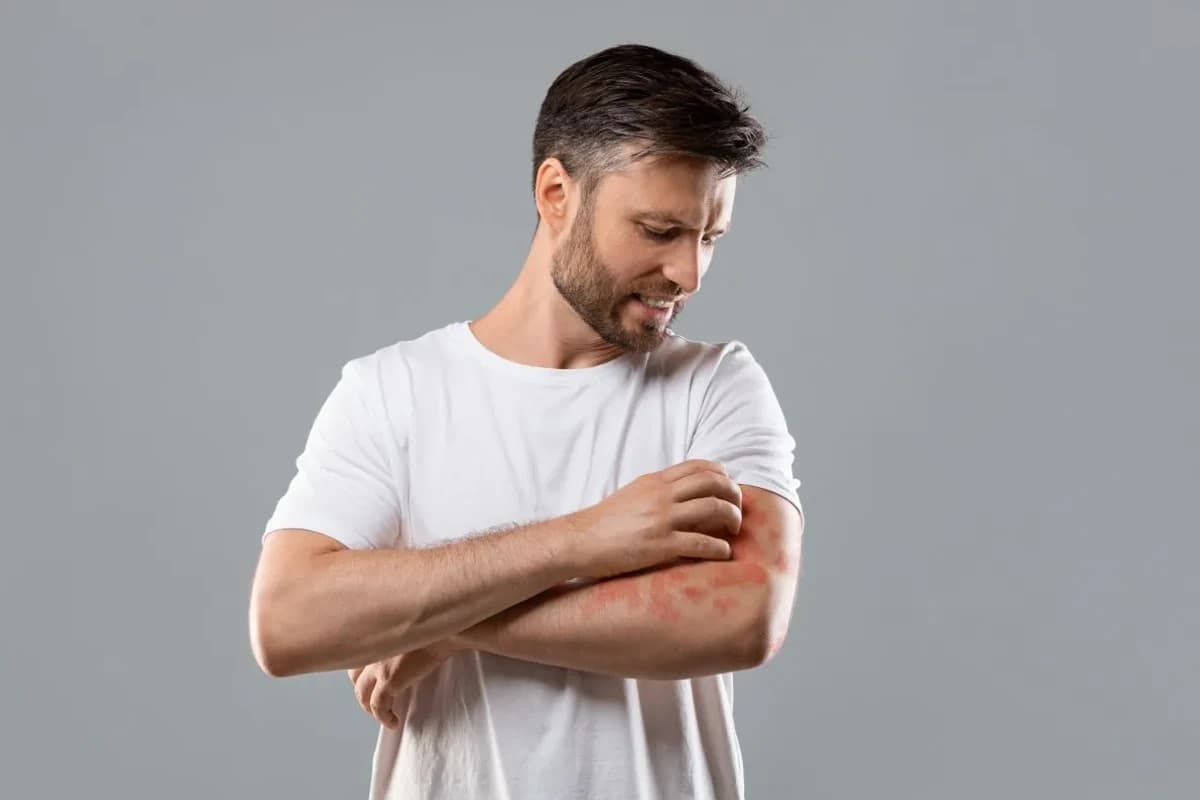 Sportul în aer liber și pielea: semnele pe care nu ar trebui să le ignori după expunerea repetată la