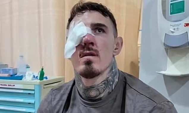 Tom Aspinall announces he is vacating UFC heavyweight title after 'multiple surgeries, accidents and