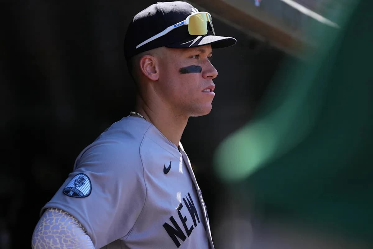 Yankees star Aaron Judge has bone bruise, will meet with doctor Tuesday